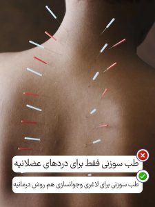 تعداد و عمق سوزن در طب سوزنی باید متناسب با برنامه درمانی باشد