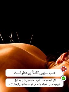 سه باور غلط درباره طب سوزنی و نکات مهم پیش از شروع درمان
